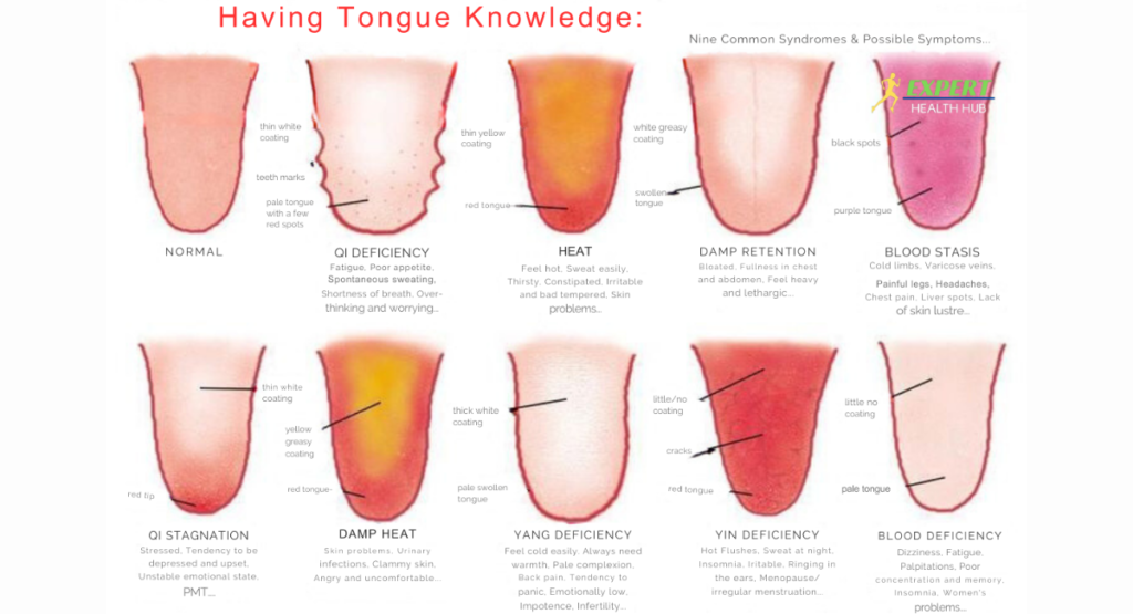 Tongue-Health-Chart