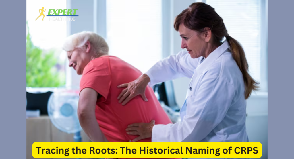 Tracing the Roots: The Historical Naming of CRPS