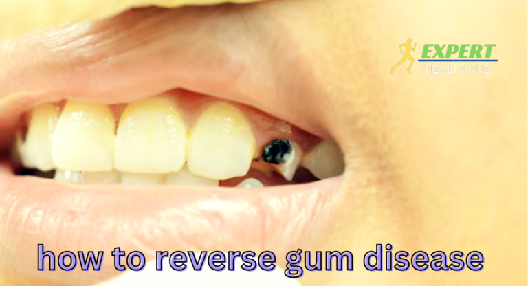 How-to-reverse-gum-disease