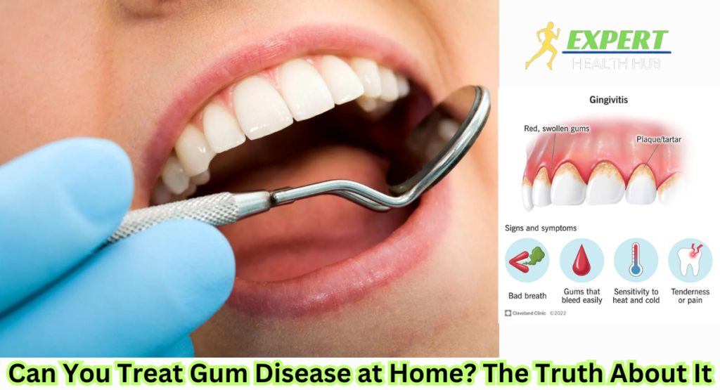 Can You Treat Gum Disease at Home? The Truth About It