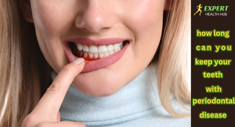 how long can you keep your teeth with periodontal disease