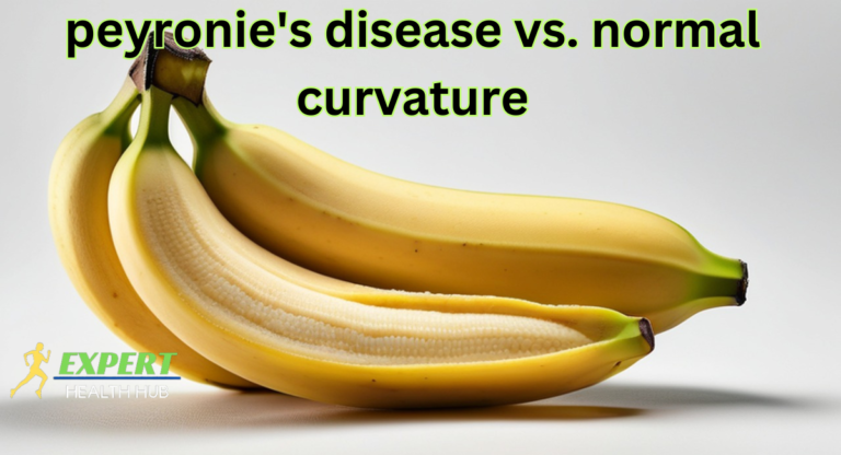 peyronie's disease vs. normal curvature