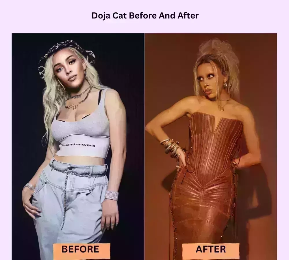 Doja Cat Weight Loss and What We Can Learn from It