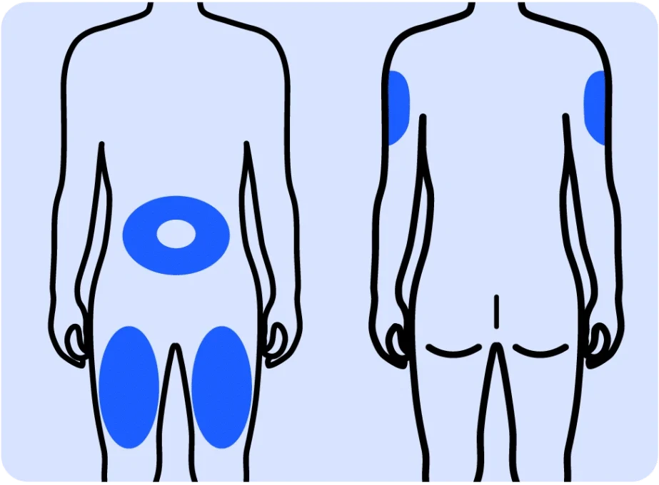 The Best Places to Inject Mounjaro for Weight Loss